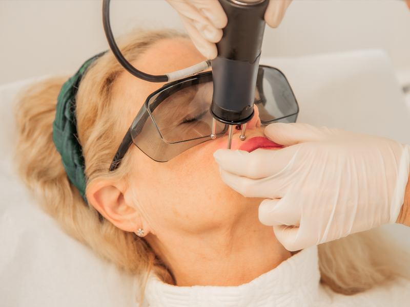 Juliet Laser Behandlung