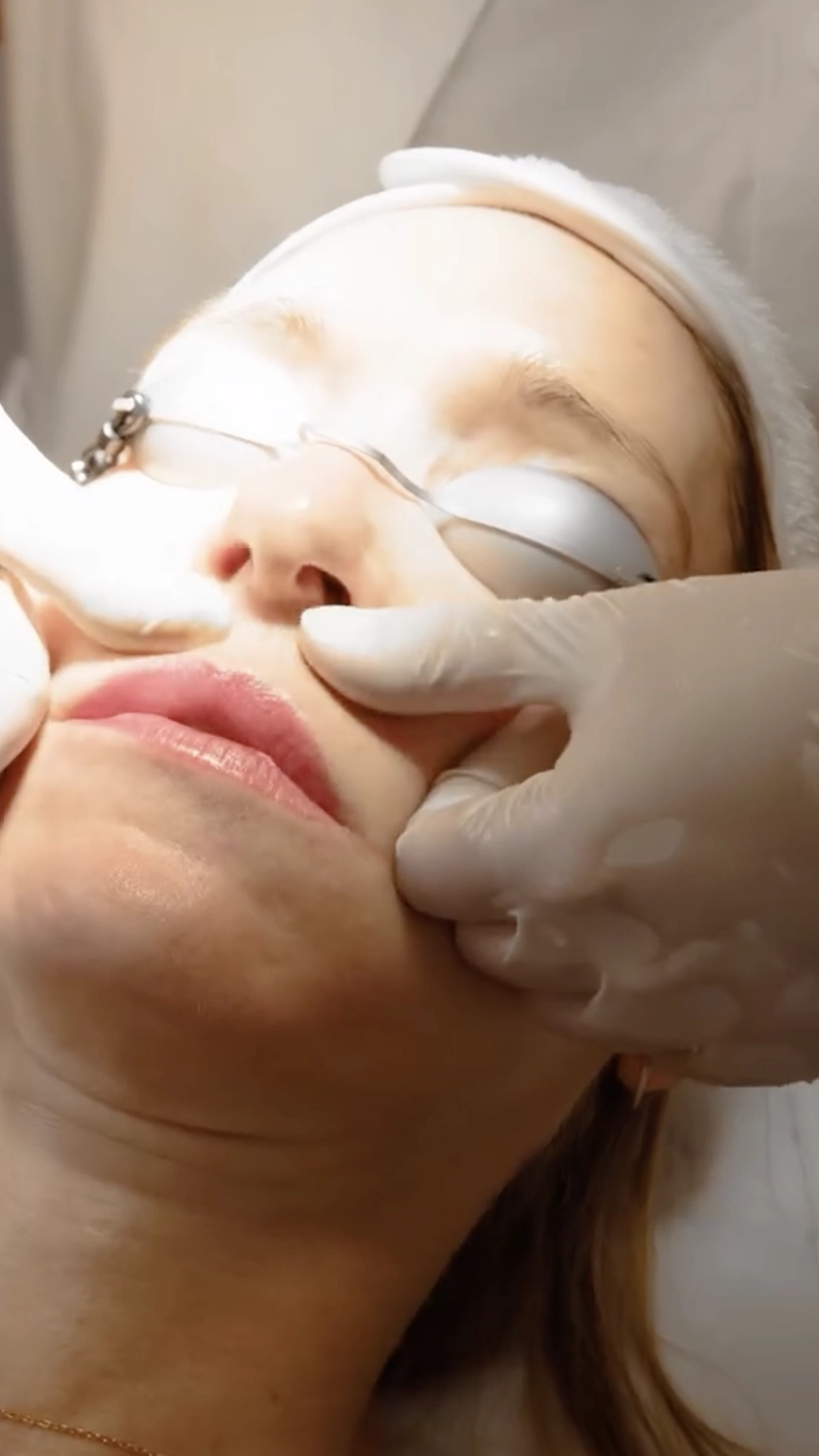 Vorschaubild: eine Haut wirkt fahl, uneben oder zeigt erste Anzeichen von Sonnenschäden? Dann kann ein sanftes chemisches Peeling helfen, deinen Teint aufzufrischen und die Hauterneuerung zu fördern.